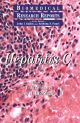 Hepatitis C
