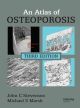 Atlas of Osteoporosis