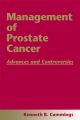 Management of Prostate Cancer